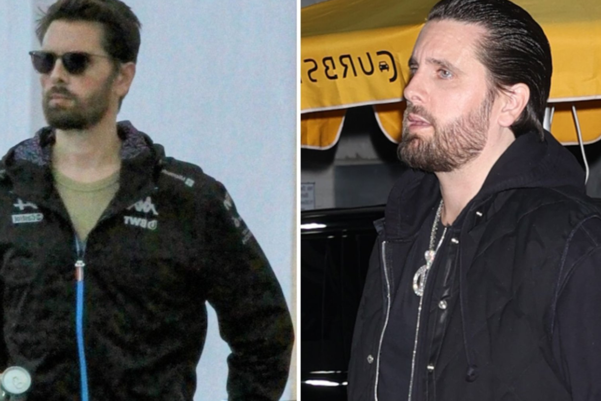 scott disick weight gain