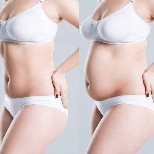 Apple Cider Vinegar's Effect on Appetite Suppression for Belly Fat Loss