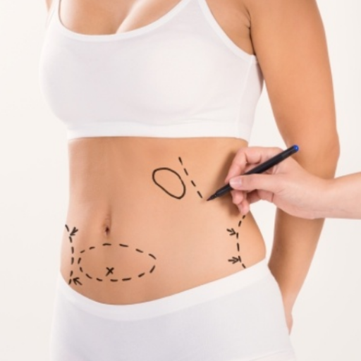 Spot Reduction Can Target Belly Fat