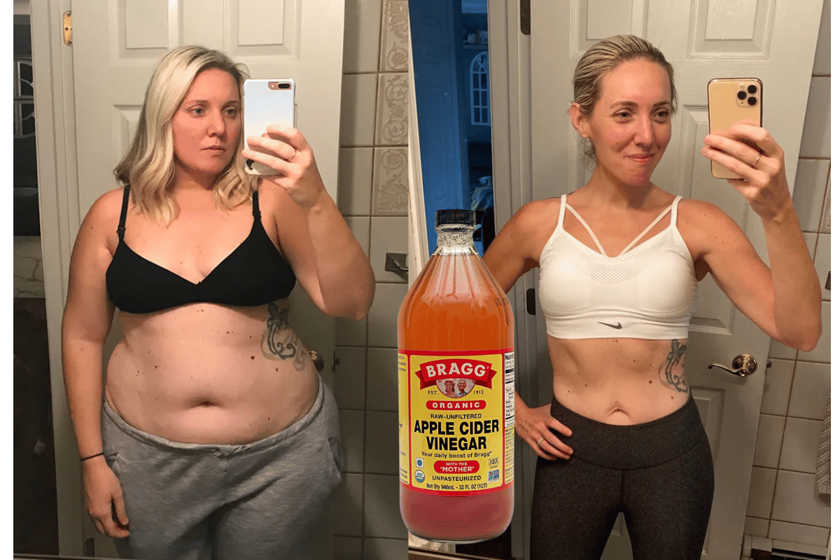 apple vinegar to lose weight 