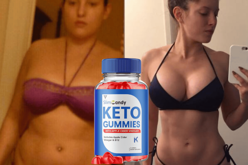 keto and acv gummies