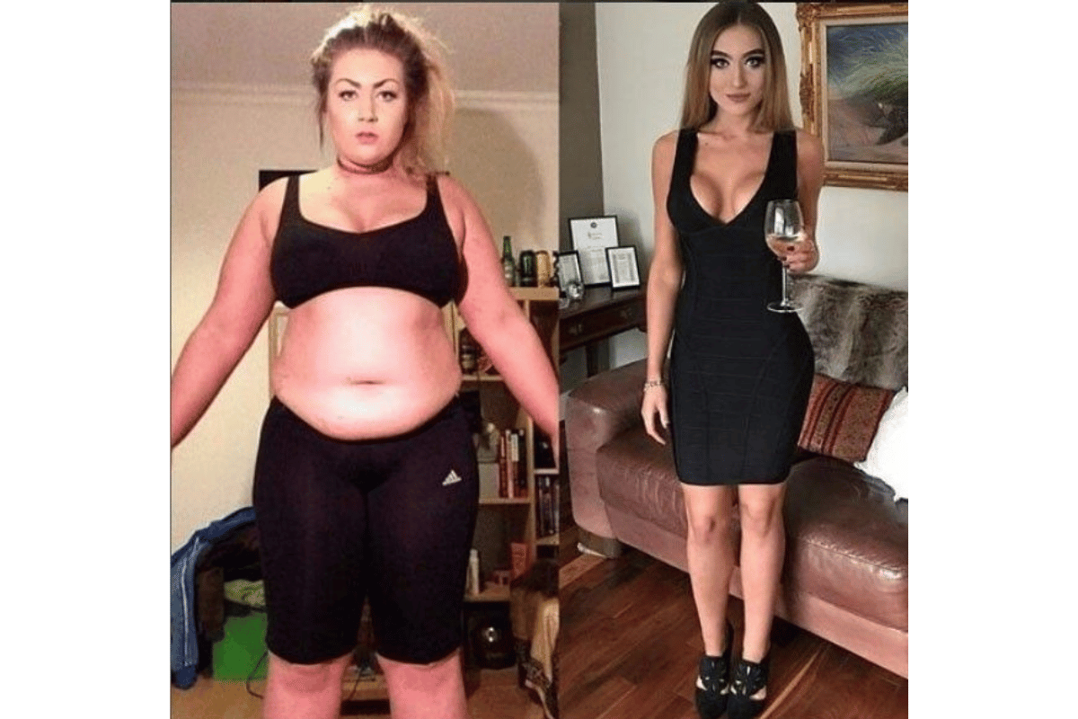 best weight loss gummies