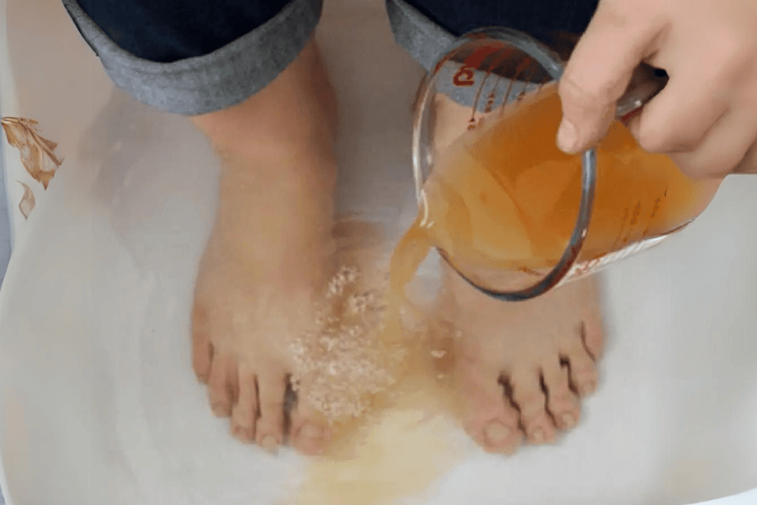 Apple Cider Vinegar on Feet for Weight Loss
