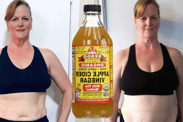 Apple Cider Vinegar on Feet Weight Loss