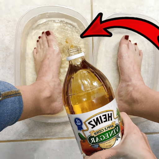 Apple Cider Vinegar on Feet for Weight Loss
