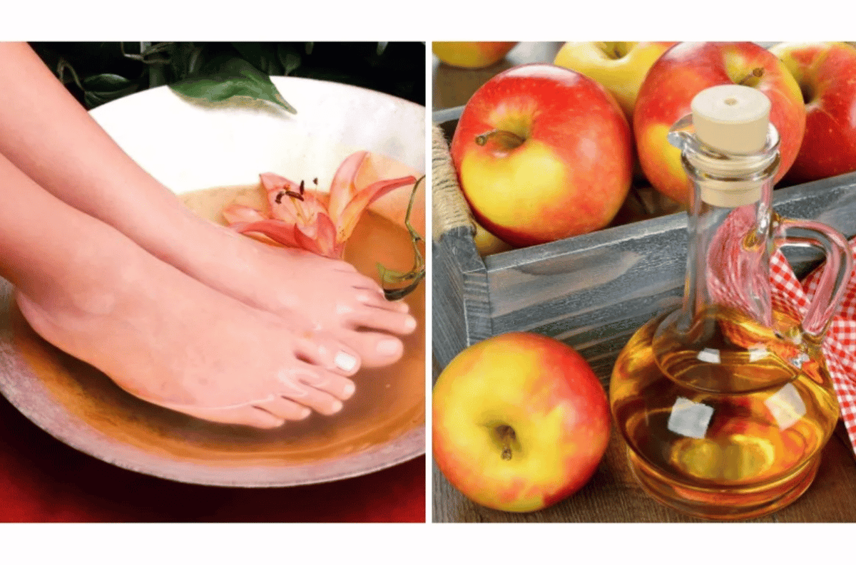 apple cider vinegar on feet weight loss