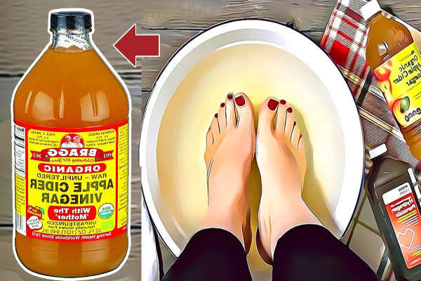apple cider vinegar feet weight loss