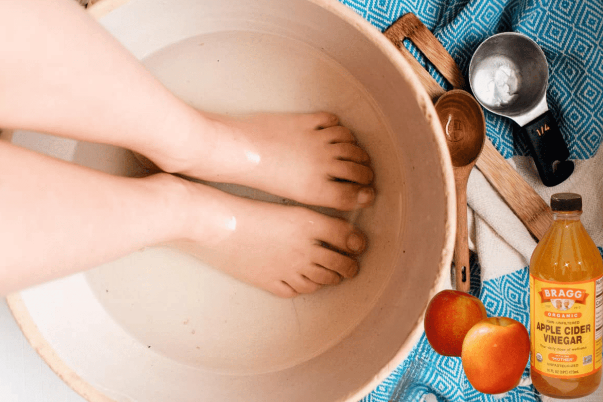 apple cider vinegar on feet weight loss