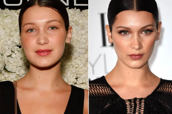 bella hadid weight loss