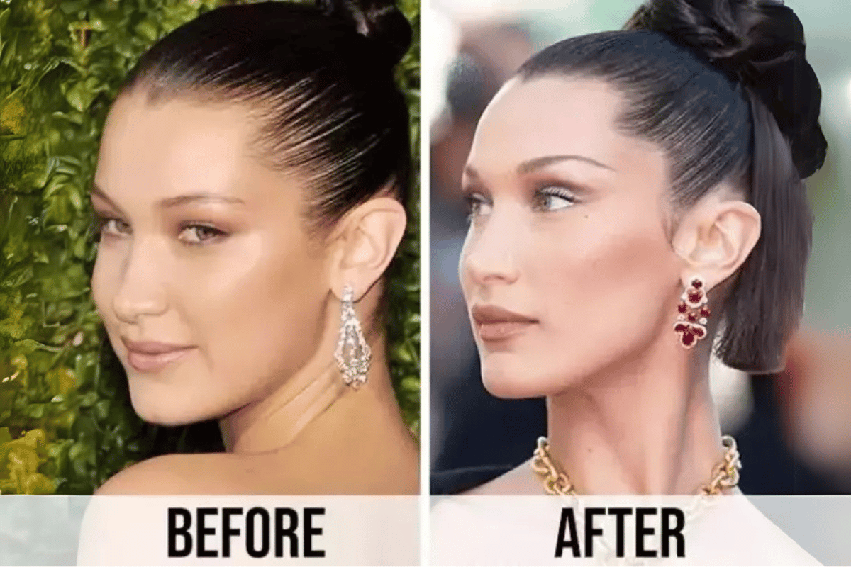 bella hadid weight loss