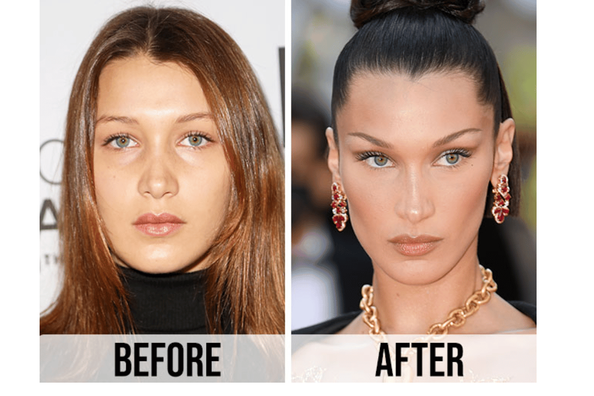 bella hadid weight loss