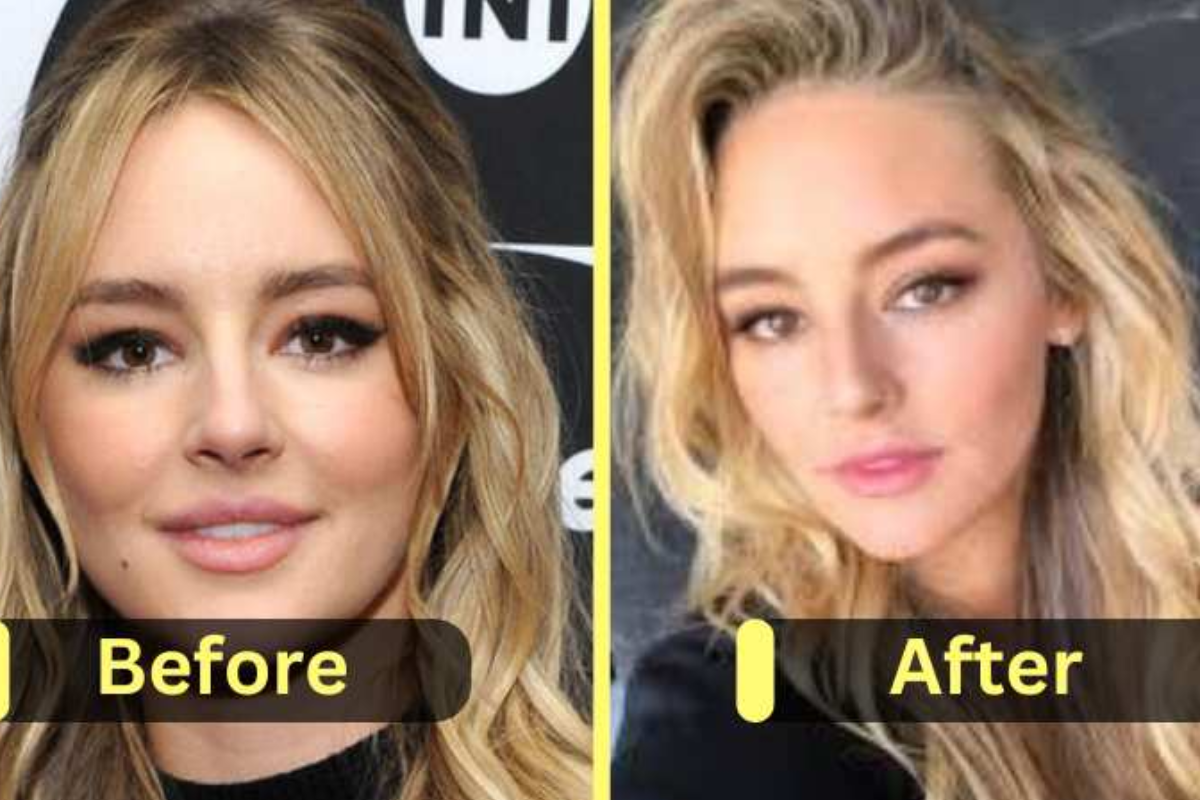 Introduction: Hassie Harrison’s Inspiring Weight Loss Story