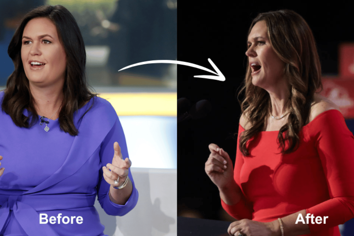 sarah huckabee sanders weight loss surgery
