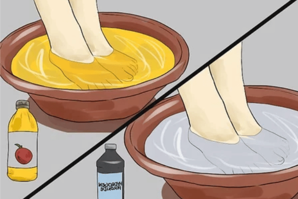 soaking feet in apple cider vinegar for lose weight