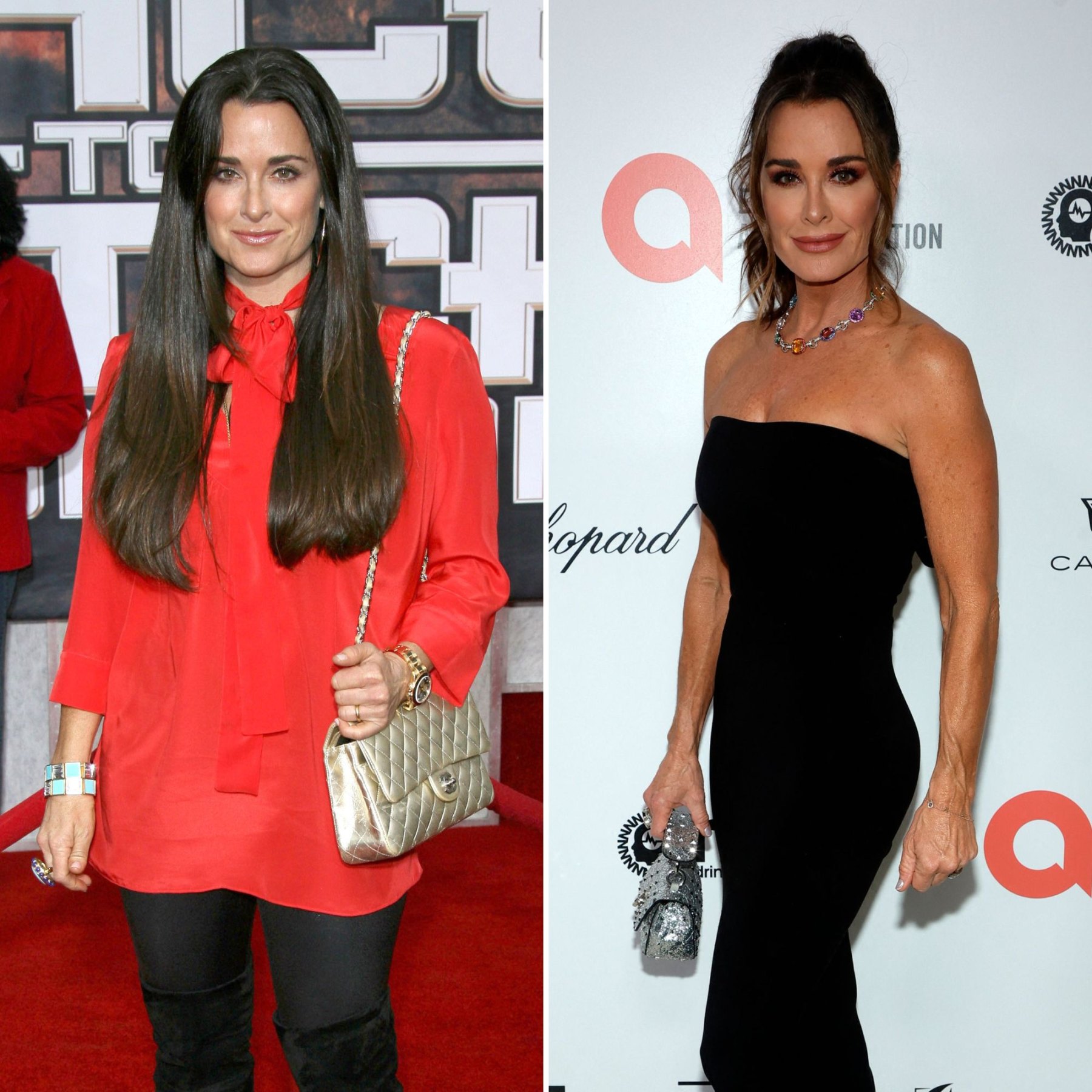 kyle richards weight loss