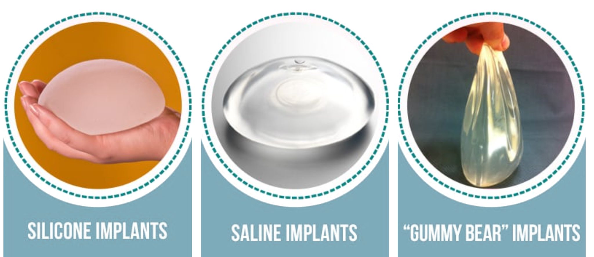 gummy bear implants near me
